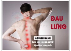 Nguyên nhân dẫn đến chứng đau lưng | Phòng khám đa khoa Hoàn Cầu