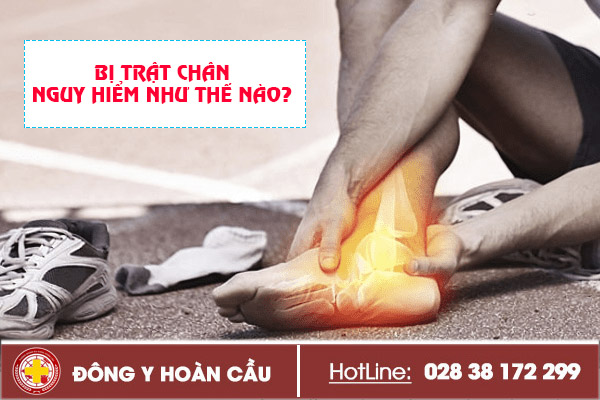 Bị trật chân nguy hiểm như thế nào? | Phòng khám đa khoa Hoàn Cầu