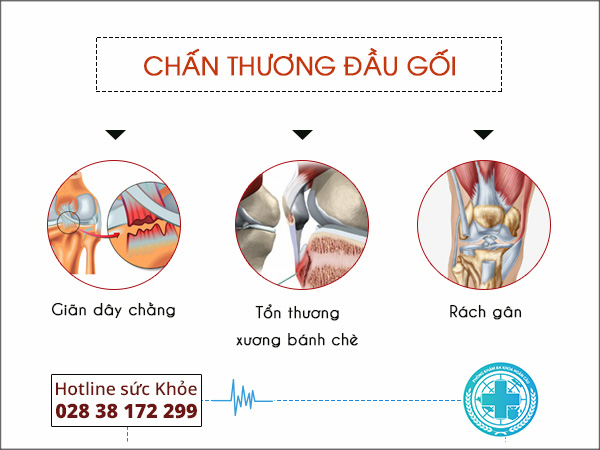 Bệnh đau đầu gối: mối đe dọa cho hệ thống xương khớp của bạn | Phòng khám đa khoa Hoàn Cầu