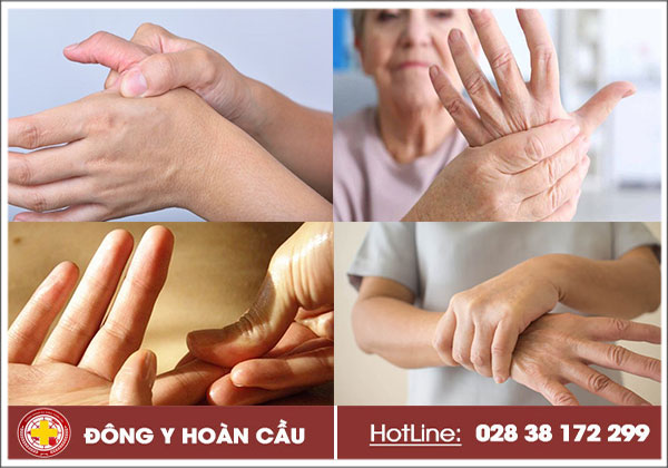 Tê tay tê đầu ngón tay cảnh báo nguy cơ mắc bệnh xương khớp | Phòng khám đa khoa Hoàn Cầu