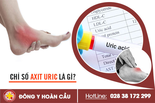 Chỉ số axit uric là gì? | Phòng khám đa khoa Hoàn Cầu