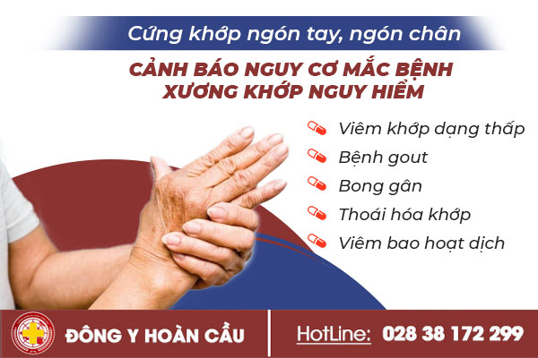 Cứng khớp ngón tay, ngón chân - cảnh báo nguy cơ mắc bệnh xương khớp nguy hiểm | Phòng khám đa khoa Hoàn Cầu