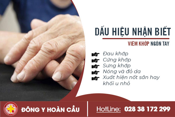 Dấu hiệu nhận biết viêm khớp ngón tay và cách chữa trị hiệu quả hiện nay | Phòng khám đa khoa Hoàn Cầu