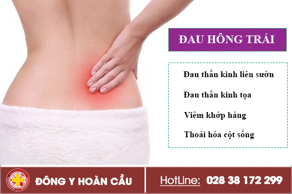 Đau hông trái cảnh báo sức khỏe đang có vấn đề - hãy cẩn trọng ngay | Phòng khám đa khoa Hoàn Cầu