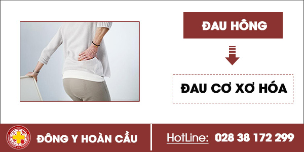 Đau hông dấu hiệu cảnh báo về những bệnh xương khớp nguy hiểm | Phòng khám đa khoa Hoàn Cầu