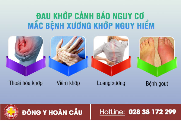 Đau khớp - cảnh báo nguy cơ mắc bệnh xương khớp nguy hiểm | Phòng khám đa khoa Hoàn Cầu