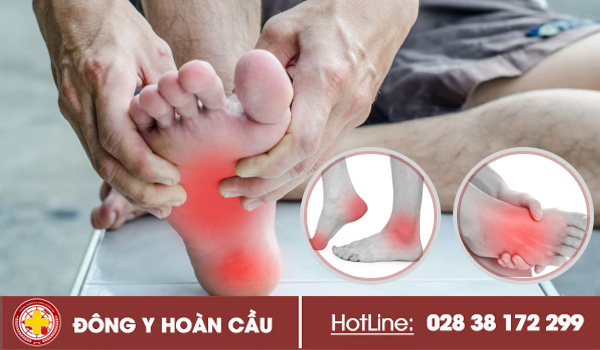 Đau nhức bàn chân là triệu chứng bệnh gì? điều trị thế nào hiệu quả? | Phòng khám đa khoa Hoàn Cầu