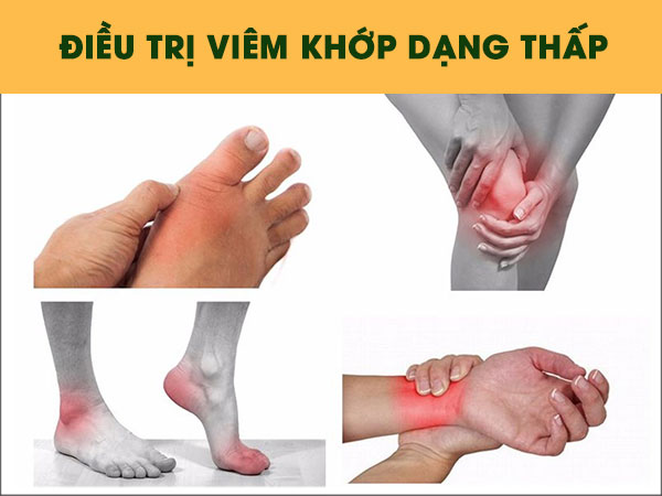 Nguyên nhân dấu hiệu và cách chữa trị bệnh thấp khớp | Phòng khám đa khoa Hoàn Cầu