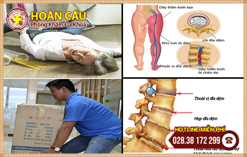 Nguyên nhân đau lưng dưới thường gặp nhất | Phòng khám đa khoa Hoàn Cầu