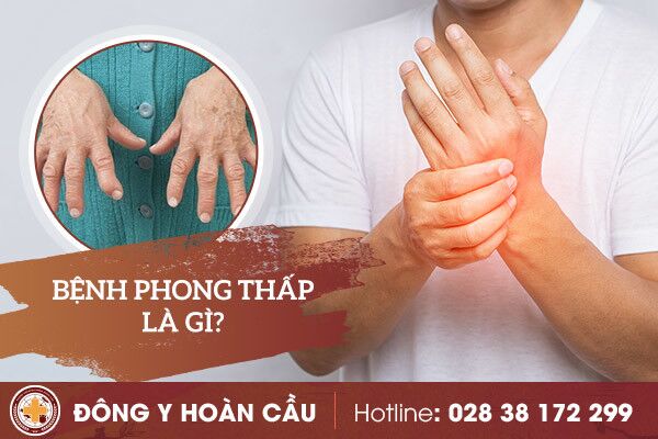 Phong thấp là gì? triệu chứng phong thấp? | Phòng khám đa khoa Hoàn Cầu