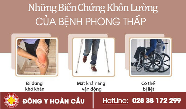 Sự Nguy Hiểm Của Phong Thấp Và Liệu Trình Chữa Phong Thấp Không Tái Phát | Phòng khám đa khoa Hoàn Cầu