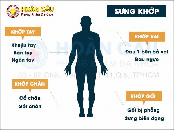 Tìm hiểu về bệnh sưng khớp và những nguy hiểm mà nó mang lại | Phòng khám đa khoa Hoàn Cầu