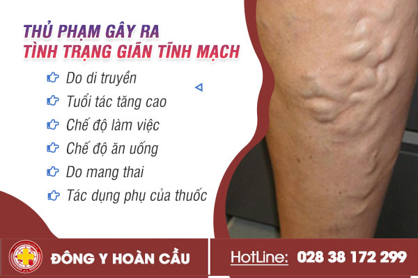 Tại sao bị giãn tĩnh mạch? Cách điều trị hiệu quả như thế nào? | Phòng khám đa khoa Hoàn Cầu