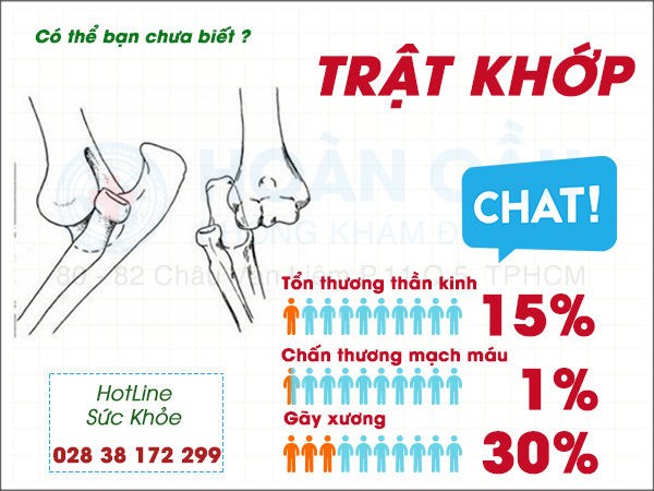 Bệnh trật khớp và những điều cần biết | Phòng khám đa khoa Hoàn Cầu