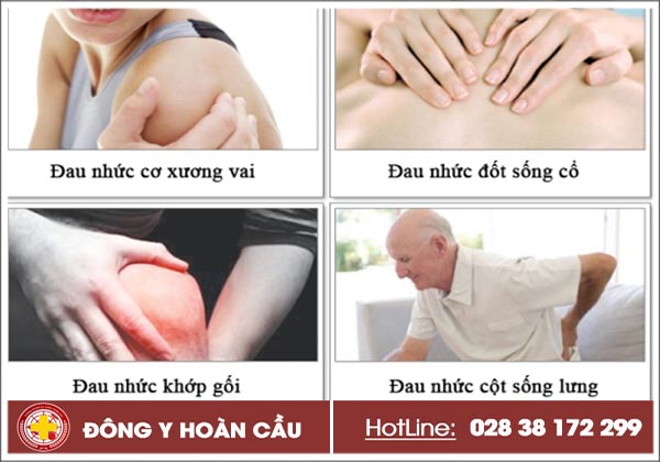 Vì sao bệnh nhân tỉnh Bình Phước lựa chọn Phòng Khám Xương Khớp Hoàn Cầu TPHCM? | Phòng khám đa khoa Hoàn Cầu