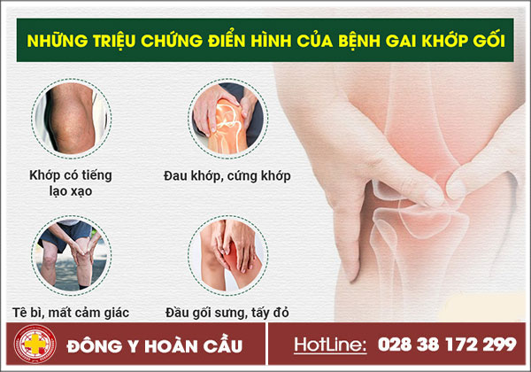 Bệnh gai khớp gối nỗi ám ảnh tuổi trung niên | Phòng khám đa khoa Hoàn Cầu