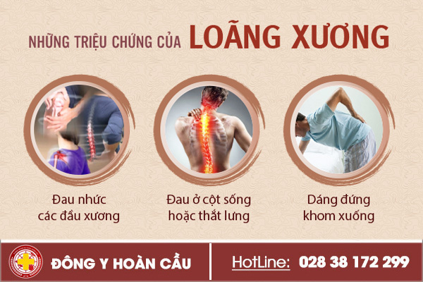 Những triệu chứng loãng xương cần điều trị sớm | Phòng khám đa khoa Hoàn Cầu