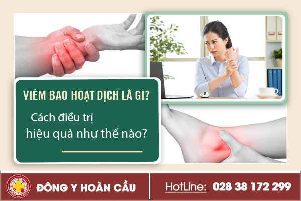 Viêm bao hoạt dịch là gì? Cách điều trị hiệu quả như thể nào? | Phòng khám đa khoa Hoàn Cầu