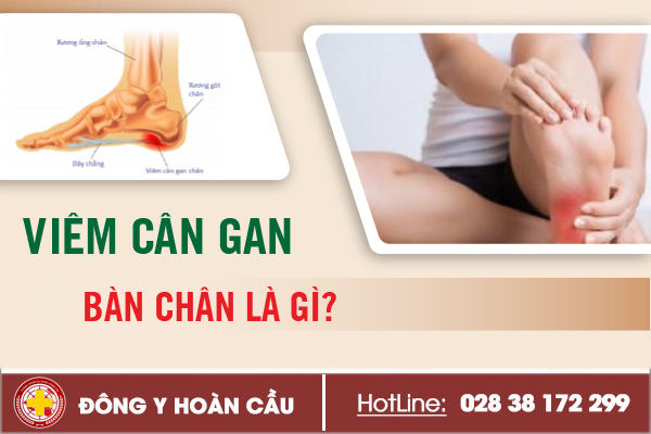 Viêm cân gan bàn chân là gì? triệu chứng nhận biết như thế nào? | Phòng khám đa khoa Hoàn Cầu