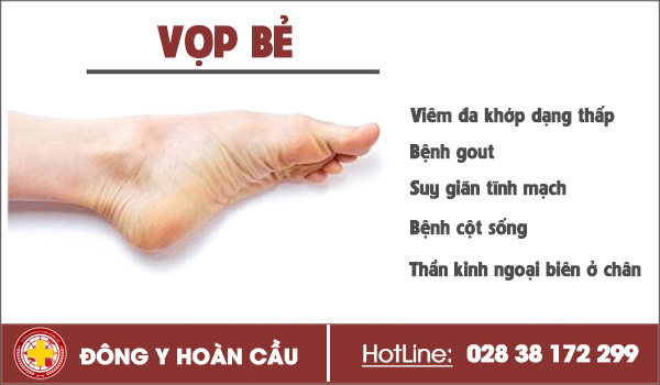 Chân thường xuyên bị vọp bẻ là bị gì? | Phòng khám đa khoa Hoàn Cầu