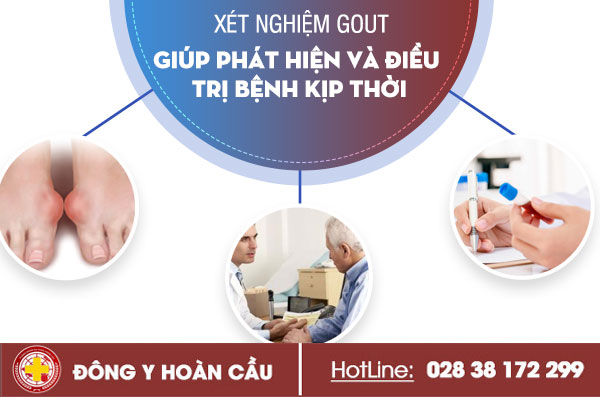 Xét nghiệm gout - giúp phát hiện và điều trị bệnh kịp thời | Phòng khám đa khoa Hoàn Cầu