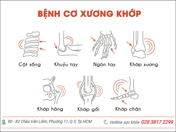 Bệnh viện chuyên khoa xương khớp uy tín tại TP.HCM | Phòng khám đa khoa Hoàn Cầu